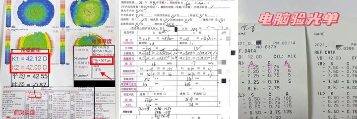准备做近视手术的朋友进来听句劝吧！前眼科员工的真心忠告
